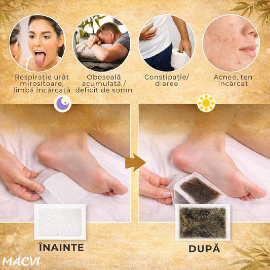 Plasturi detoxifiere, Macvi®, cu ghimbir, 10 bucati, pentru picioare