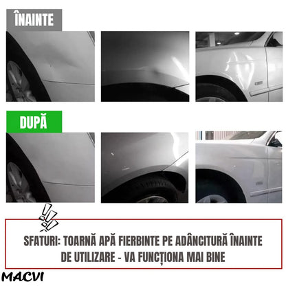 Ventuza puternica Macvi® pentru indepartarea indoiturilor auto, caroserii mari, diametru 12 cm