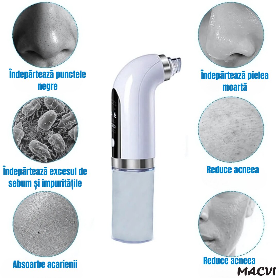 Aparat Curatare Fata Macvi® Profesional, Vacuum Puncte Negre, Tehnologie Micro-Bule si Sterilizare cu Apa, 5 Capete, Portabil, Alb