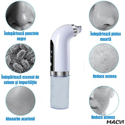 Aparat Curatare Fata Macvi® Profesional, Vacuum Puncte Negre, Tehnologie Micro-Bule si Sterilizare cu Apa, 5 Capete, Portabil, Alb