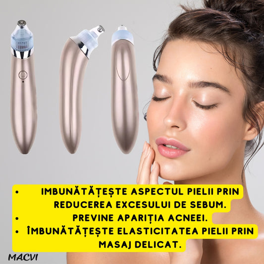 Aparat Vacuum Presure Cleaner Macvi® pentru Curatarea Tenului, Puncte Negre si Grasime