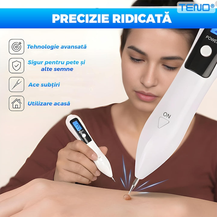 Stilou cu Plasma Teno®, pentru indepartarea alunitelor, petelor pigmentare, accesorii incluse, eficienta ridicata, autonomie mare, afisaj digital, alb