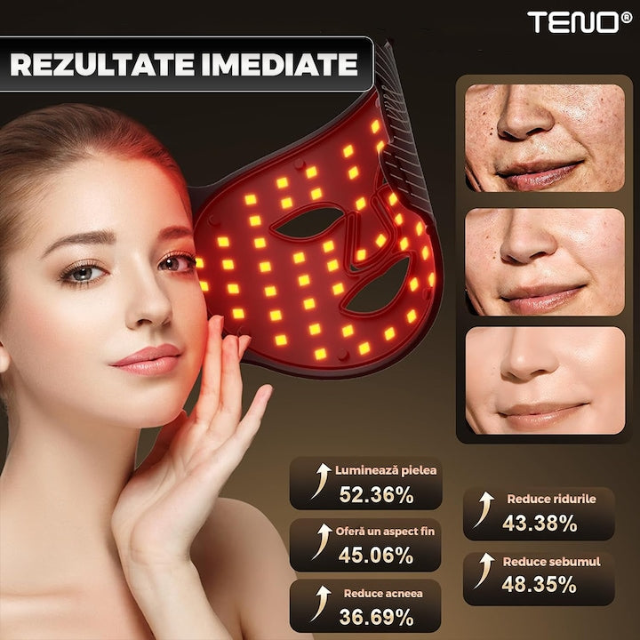 Masca Faciala cu Tratament LED Teno®, fototerapie, 8 moduri de iluminare, elimina ridurile si petele pigmentare, anti-acnee, anti-imbatranire, pentru toate tipurile de ten, negru
