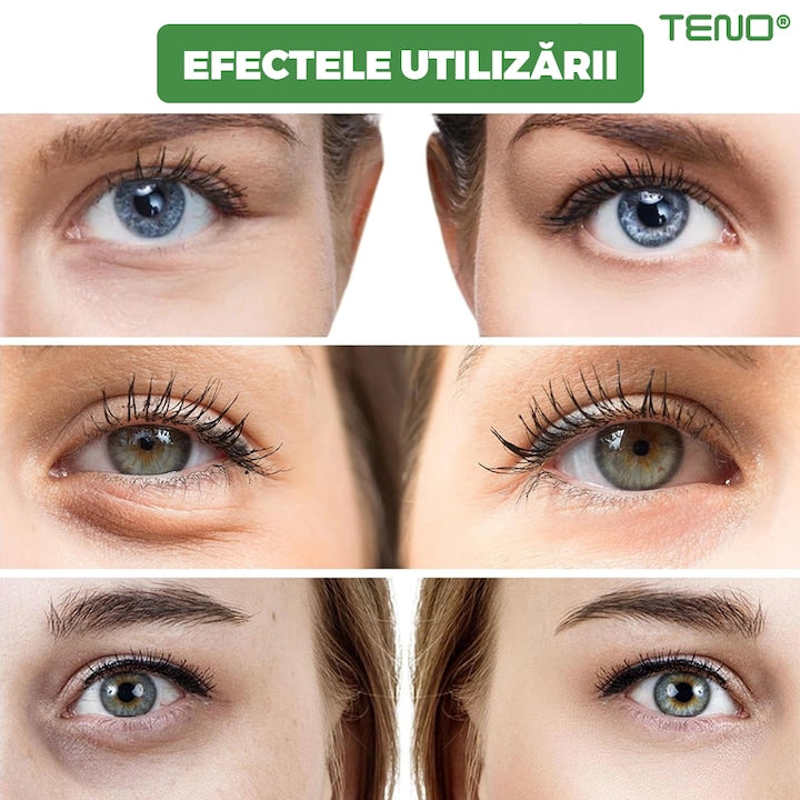 Set 60 de Plasturi pentru Ochi Teno®, cu alge marine, hialuronat de sodiu, hidratanti, pentru ingrijirea ochilor, lumineaza cercurile ochilor, reduc pungile de sub ochi, verde