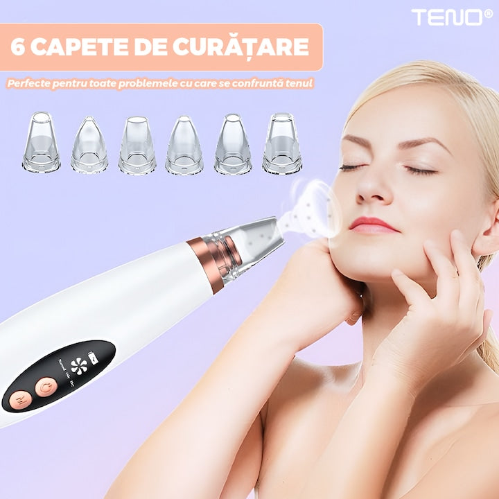 Aparat cu Vacuum pentru Puncte Negre si Grasime Teno®, curatare faciala, ingrijire faciala, 3 viteze, 6 capete interschimbabile, delicat cu pielea, afisaj digital, alb