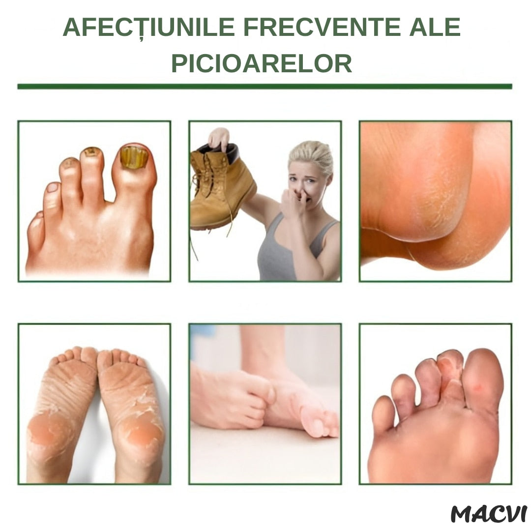Sosete cu masca exfolianta pentru picioare Macvi®, 1 pereche, hidratare intensa, exfoliere delicata, eliminarea mirosurilor, ingrijire naturala pentru piele catifelata