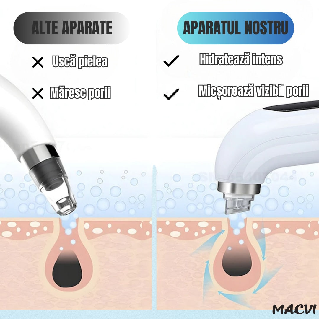 Aparat Curatare Fata Macvi® Profesional, Vacuum Puncte Negre, Tehnologie Micro-Bule si Sterilizare cu Apa, 5 Capete, Portabil, Alb