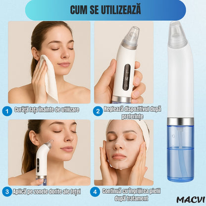 Aparat Curatare Fata Macvi® Profesional, Vacuum Puncte Negre, Tehnologie Micro-Bule si Sterilizare cu Apa, 5 Capete, Portabil, Alb