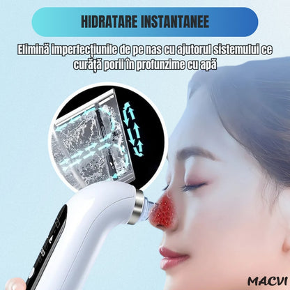 Aparat Curatare Fata Macvi® Profesional, Vacuum Puncte Negre, Tehnologie Micro-Bule si Sterilizare cu Apa, 5 Capete, Portabil, Alb
